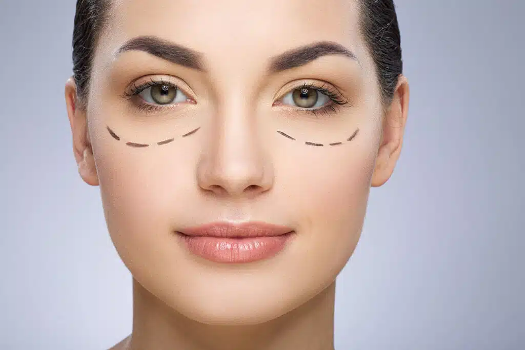 blepharoplasty clinic in panipat